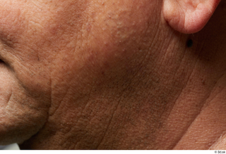 HD Face Skin Umberto Espinar cheek chin skin texture wrinkles…